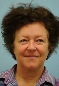 Eyebrow Transplant: See This Before & After