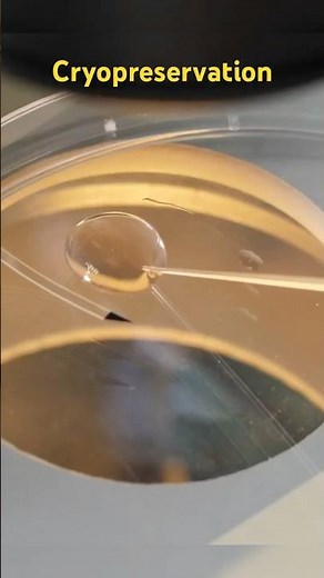 Cryopreservation: Freezing today Thriving tomorrow!!