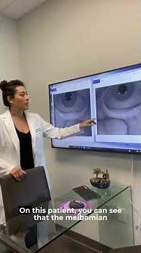 What are Meibomian Glands?