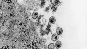 How HIV & AIDS Redefined the Fight Against Infectious Diseases | Britannica