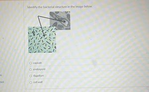 Identify the bacterial structure in the image below.capsuleen... | Filo