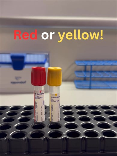 Do you know which are needed!? #tube #phlebotomistlife #students #foryou #healthcare #blooddraw #healthcareworker #phleblife #lablife #fypシ #phlebotomystudent #phlebotomytraining #learning #phlebotomy #phlebotomist #lablife🔬 #foryoupage #PhlebotomyChallenge #studentlife #student