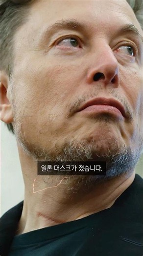Elon Musk's Shocking Defeat