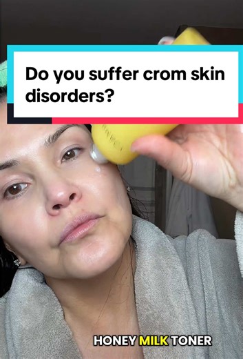 Skin disorders like eczema and scleroderma? You need to protein the barrier and elasticity without harsh ingredients @Farmacy Beauty #skin