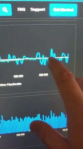 🔥 Hive OS fora do ar - O que fazer? #shorts