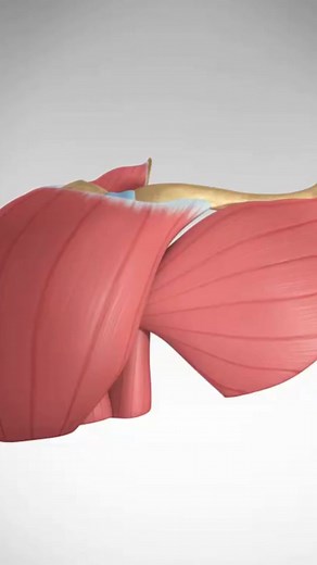 See a Proximal Biceps Tear, Rupture, and Repair - 3D animation #baseball #swimming #weightlifting #bicepstear #surgeryanimation