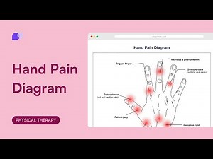Hand Pain Diagram
