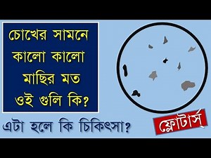 What are Floaters in eyes: causes, and treatment. #eyefloaters #eyeflashes#dr.bhaskarDey