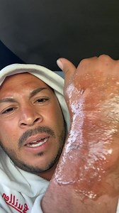 . 🥹AYUDAAAA BANDITA🥹 Qué me puedo poner qué me recomiendas mi gente me duele mi manita bien feo🥴☹️🥹🙏🏻… | Julio Guillen