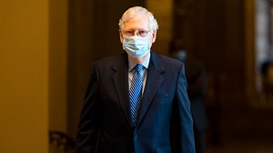 McConnell claims 'no concern' after photos show his hand bandaged, discolored
