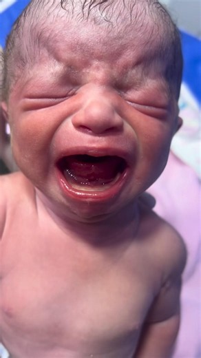 Moro Reflex #nicu #newborn #medical #premature