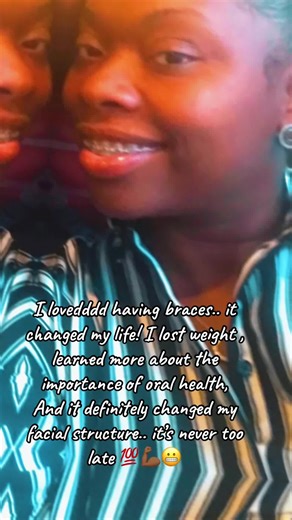 Braces was really a great time of my life.. It definitely had its challenges.#braces #braceface #😂