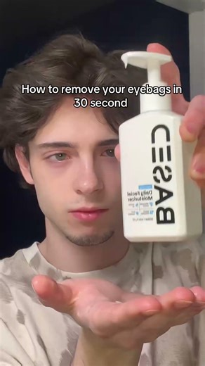 Eyebags change the way you look. Remove them and you can look good to 🧛🏻🔨 #short #shorts #ethentrip