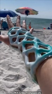 2.5M views · 6.4K reactions | Cast 21 for broken bones #facts #challenge #picturechallenge #photo #photographychallenge #PhotoEditingChallenge #bestphotochallenge #factsdaily #picture #photochallenge #siycology #virals #viralpost #viralfacts #viralpage #trandingreels2024 | Need To Know | Facebook