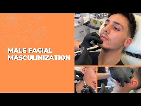MALE FACIAL MASCULINIZATION WITH DERMAL FILLERS | Dr. Jason Emer