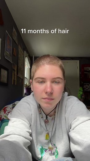 Signs to Shave Your Head: Growing Out a Buzzcut