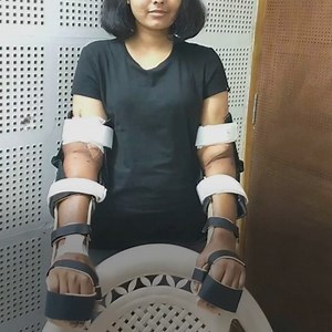 1.2M views · 10K reactions | She tragically lost both arms and only had one option left, to receive the limbs from a male donor. Now Shreya Siddanagowda's surgery has gone viral for its incredible results that have amazed the scientific community... | Positive | Facebook