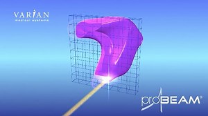 Pencil Beam Scanning