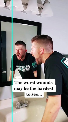 Understanding the Hidden Struggles: How PTSD Impacts Perception