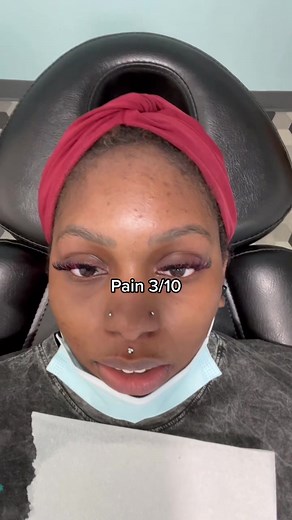 Medusa piercing 😌 #fyp #medusa #piercing #medusapiercing #blackgirlwithpiercings #blackmoms #blacktok #atlanta #finallyposting