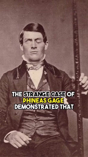 The Strange Case of Phineas Gage: Personality Changes After Brain Injury