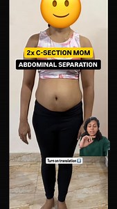 15K views · 143 reactions | COMMENT ‘HELP ME’ TO JOIN  DIASTASIS...