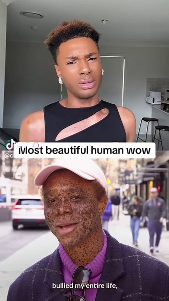 Gorgeous Man with Beautiful Freckles Deserves Modeling