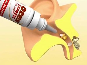 how to Melt ear wax with Otex - melting earwax with otex - Otex ear wax product review