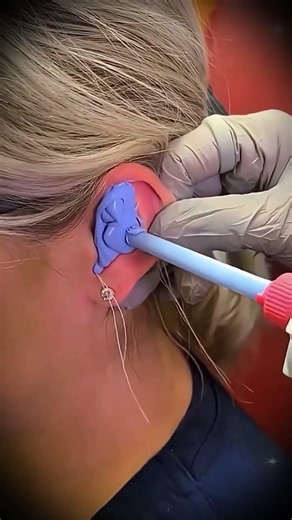 How Custom In-Ear Monitors Are Made