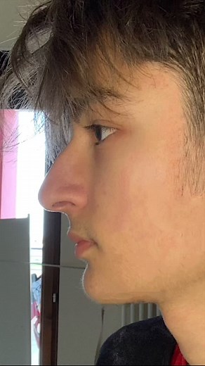 REMOVE YOUR NOSE BUMP!😱 (follow me for more beauty tips!🥰) #nosejob #nosejobcheck #beautyhacks #beauty #beautytips #learnontiktok #tiktokpartner