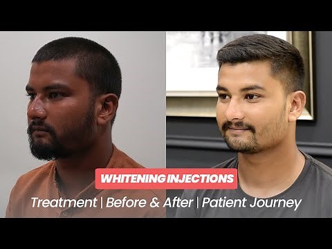 Zain's Skin Whitening Injection & IV Drips: 10 Session Results | Before & After Review 2024