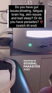 When people have big bellies, what is inside is rotten food, mucoid plaque which has hardened doesn't move through the colon. To get rid of it either one uses herbs to clean up or colonoscopy, which is what we are witnessing in the video above. | Molo Health