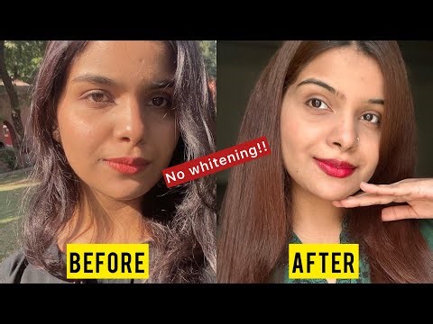 How I Got Rid Of Severe Sun Tan😭