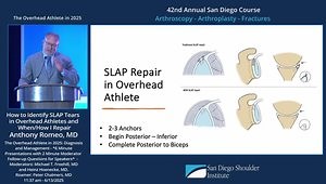 How to Identify SLAP Tears in Overhead Athletes and When/How I Repair