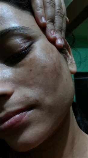 kavya natural beauty on Instagram: "Pehle aaina dekhne ka mann nahi karta tha… Ab makeup ki zarurat hi nahi padti ✨ Type Link Pp ❌ Pehle jhaiyan, pigmentation aur dull face ✅ Ab natural glow aur clear skin 😍 Sirf is home remedy se! 💖 CAPTION (HINGLISH) Pehle aaina dekhna bhi achha nahi lagta tha 😔 Face par jhaiyan, pigmentation aur dullness thi. Ab haal ye hai ki makeup ki bilkul zarurat nahi padti ✨ Chehra khud hi glow karta hai 💖 Maine use ki ye simple home remedy 👇 🥄 Mulethi powder 🥄 W