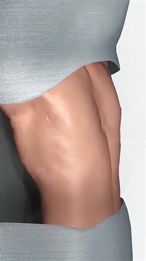 Pectus Excavatum And Nuss Procedure (3D Animation) #pectusexcavatum? #pectusexvactum #pectusexcavatumsurgery #pectusexcavatumfix #pectusexcatum