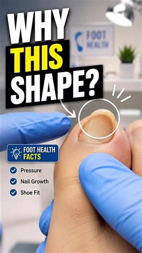 Why Is Your Toenail Curving? #shorts #FootCare #NailHealth #Podiatry