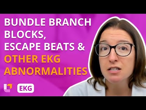 Other EKG Abnormalities - EKG Interpretation | ‪@LevelUpRN‬
