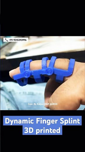 Dynamic Finger Splint 3D printed