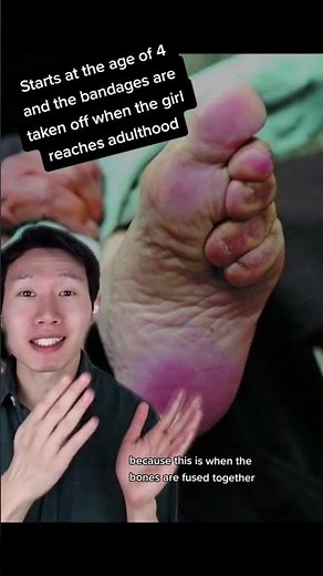 What is foot binding?