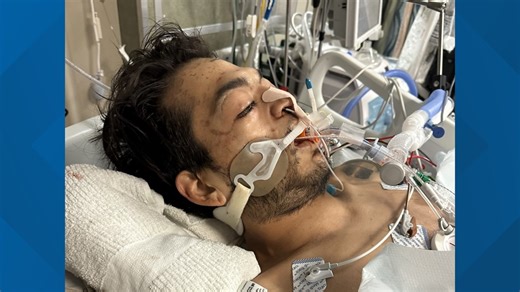 MCSO cameras weren't working to monitor sick inmate before he died, report shows.