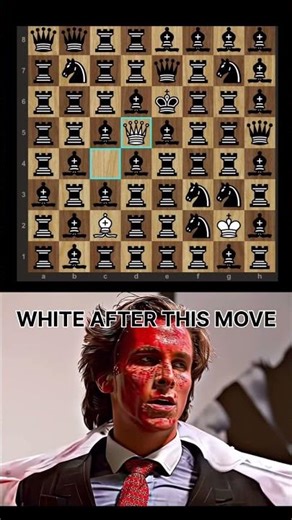 #chess #music #siciliandefense #memes #rook #guess #shorts