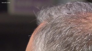 Verify: Does plucking your gray hair bring more?