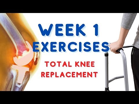 Week 1 Exercises: Total Knee Replacement