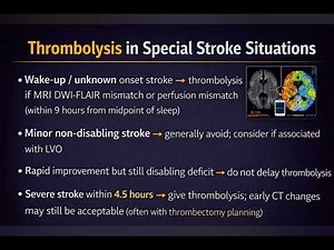 Acute Ischemic Stroke Management — Complete Guideline-Based Approach