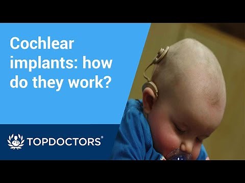 How do cochlear implants work? || What it sounds like