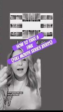 How to take a FMX (full-mouth series x-ray) #dentist #dentalassistant