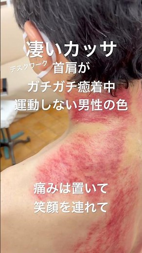 【ガッチガチの首‼️】カッサで剥がし切る‼️