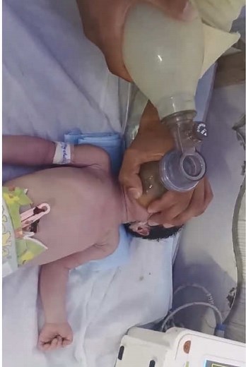 Critical Emergency | CPR, Ambu Bag, Suction & Emergency Drugs #PrematureBaby #BabyImprovement #HopeAndHealing #CriticalCare #EmergencyBaby