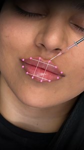 Lip Patterns 💋 Every lip has its own pattern — and reading it correctly is what makes shaping look refined, not forced. ✔️ Natural tubercles guide where volume should sit ✔️ Left and right sides rarely behave the same ✔️ Some lips need height, others need structure ✔️ The pattern tells you the technique before you inject When you understand lip patterns, you stop guessing and start designing. That’s how results heal balanced, clean, and intentional. 📲 learn my full lip pattern analysis and sha